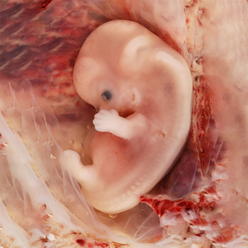 Embryo 7. Entwicklungswoche – vitaL