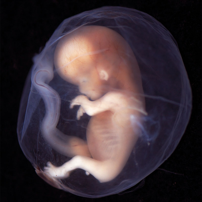Embryo 9. – 10. Entwicklungswoche – vitaL